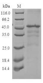 SDS-PAGE (CXCR3-2709H).jpg